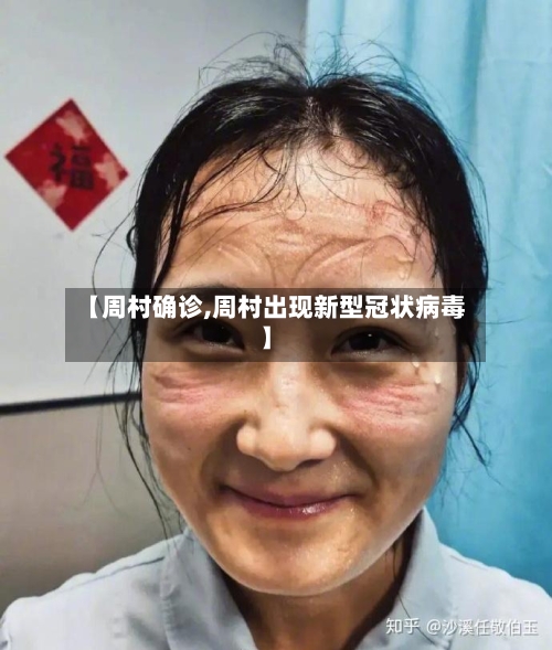 【周村确诊,周村出现新型冠状病毒】-第2张图片