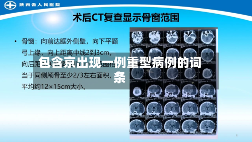 包含京出现一例重型病例的词条