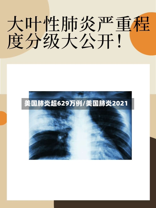 美国肺炎超629万例/美国肺炎2021-第2张图片