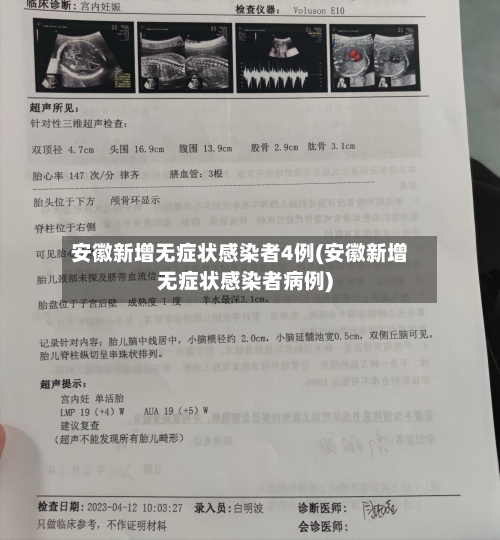 安徽新增无症状感染者4例(安徽新增无症状感染者病例)