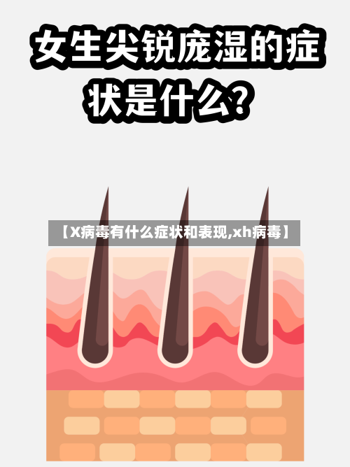 【X病毒有什么症状和表现,xh病毒】-第2张图片