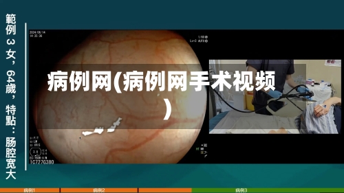 病例网(病例网手术视频)-第3张图片