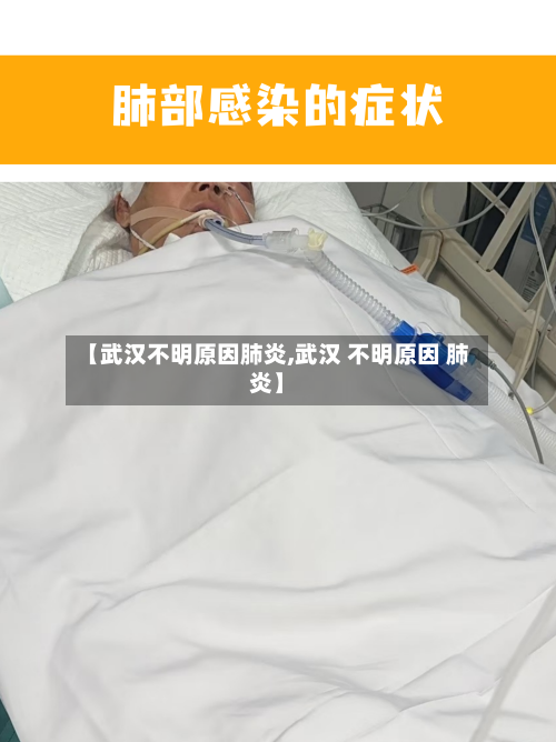 【武汉不明原因肺炎,武汉 不明原因 肺炎】-第2张图片