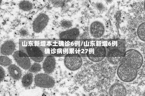 山东新增本土确诊6例/山东新增6例确诊病例累计27例