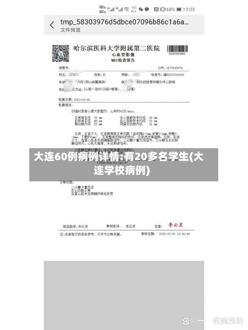 大连60例病例详情:有20多名学生(大连学校病例)