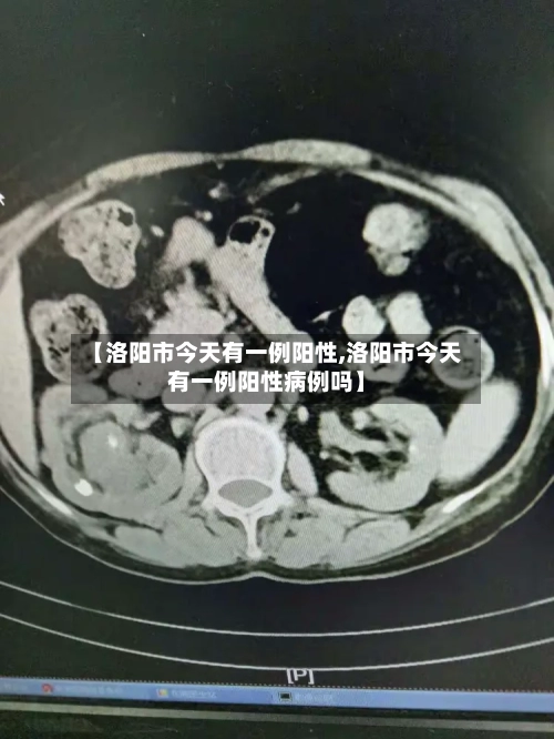 【洛阳市今天有一例阳性,洛阳市今天有一例阳性病例吗】-第2张图片