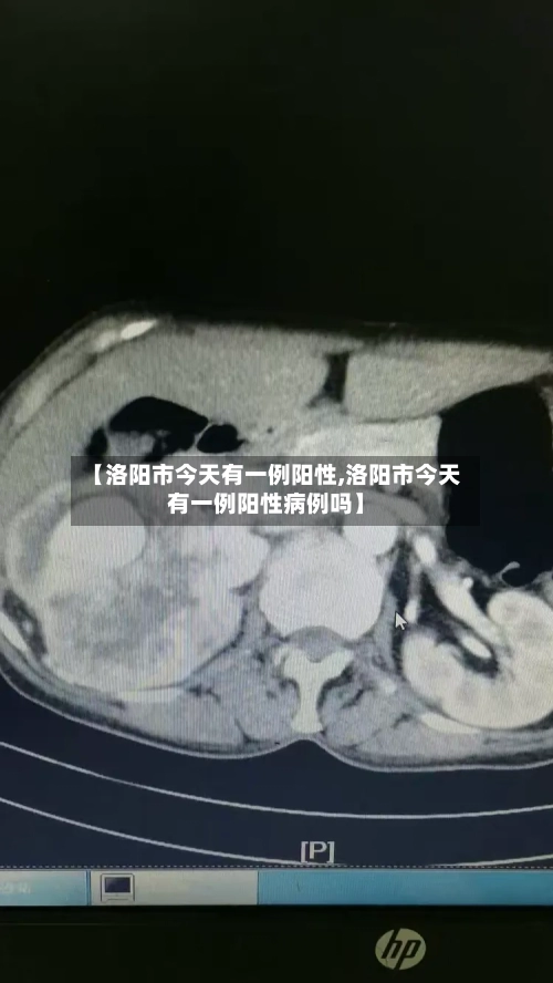 【洛阳市今天有一例阳性,洛阳市今天有一例阳性病例吗】