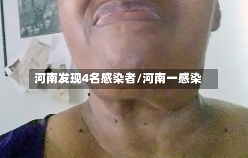 河南发现4名感染者/河南一感染